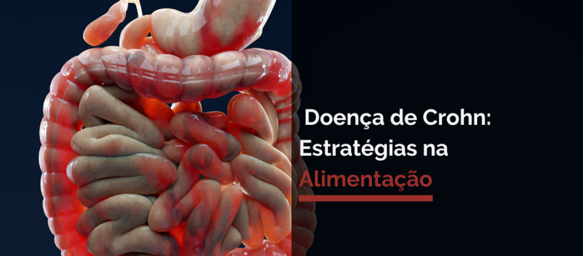 Doença de Crohn: Estratégias na Alimentação